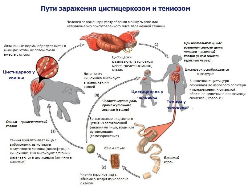 цистицеркоз крс