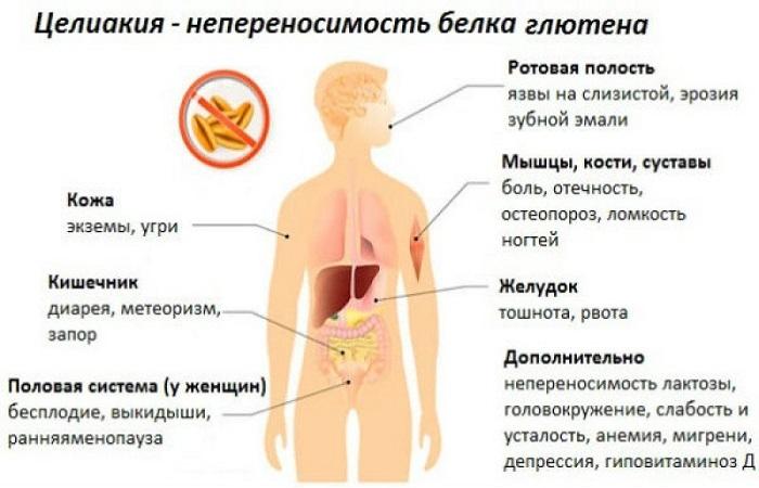 болезнь человека 